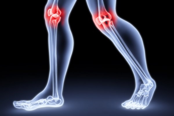 csípőízületek coxarthrosis kórtörténetét)